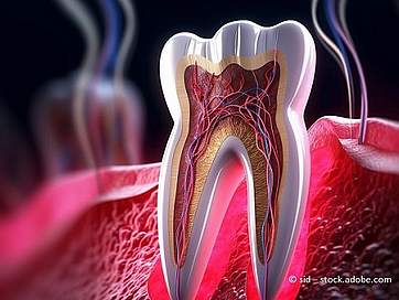 Wurzelspitzenresektion: Alles Wichtige über Kosten, Behandlung und Dauer