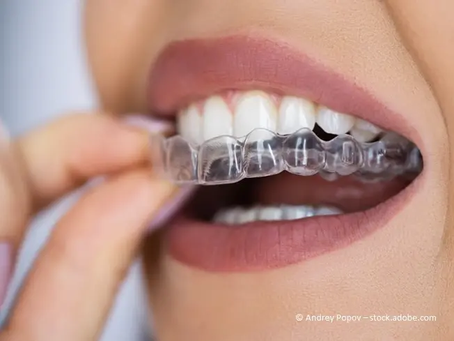 Invisalign