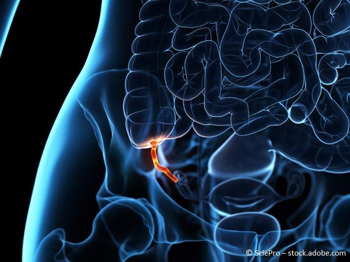 Blinddarmentzündung: Symptome erkennen, Diagnose & Behandlungsverlauf